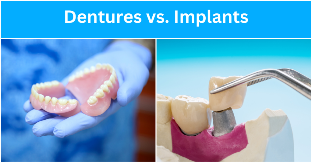 Dentures vs. Implants: What's Best For You?