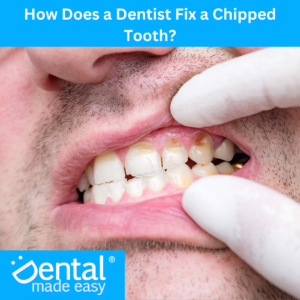 How Does a Dentist Fix a Chipped Tooth?
