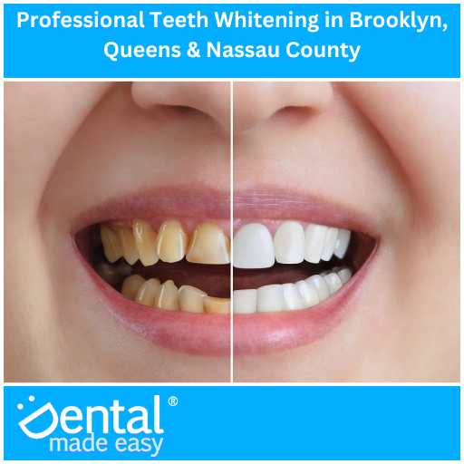 Professional Teeth Whitening - Brooklyn, Queens & Nassau County