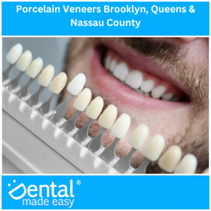 Porcelain Veneers Brooklyn, Queens & Nassau County