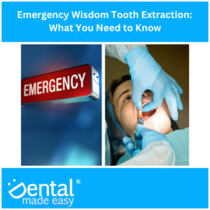 Emergency Wisdom Tooth Extraction: What You Need to Know