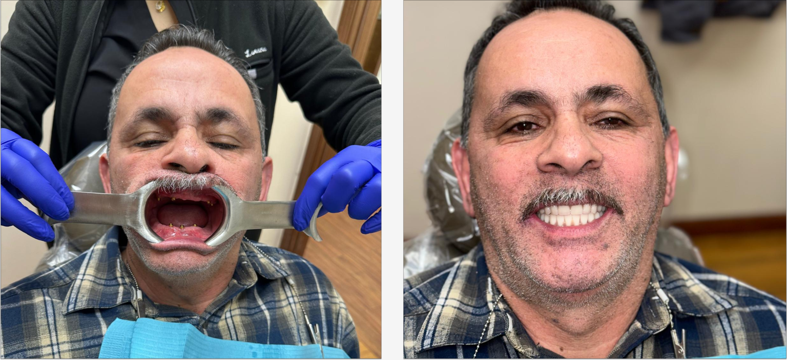 Dentist in Garden City Book Same Day Appointments Now