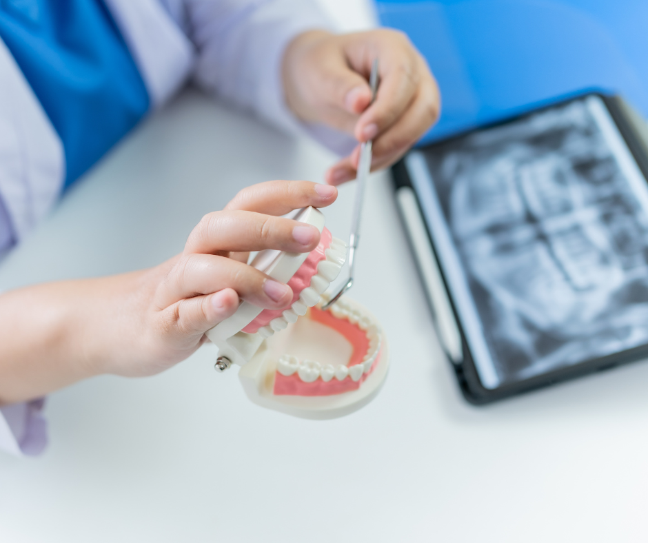Dental crowns - Dental Made Easy