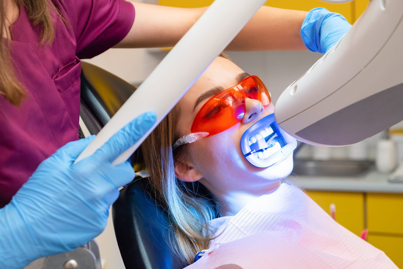 Teeth whitening - Dental Made Easy